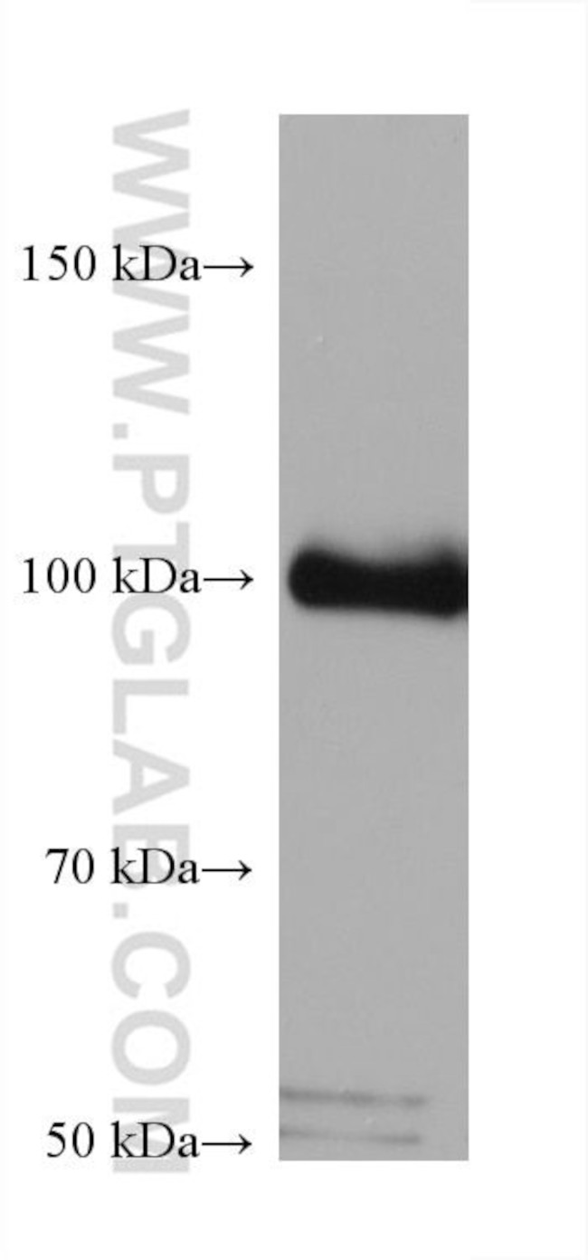 PLA2G4A Antibody in Western Blot (WB)