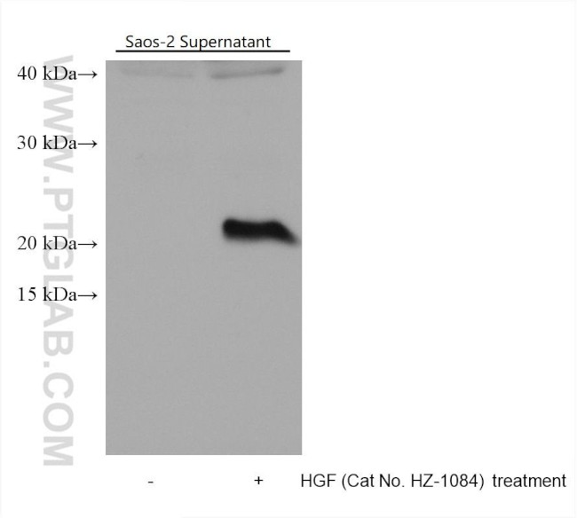 IL-11 Antibody in Western Blot (WB)