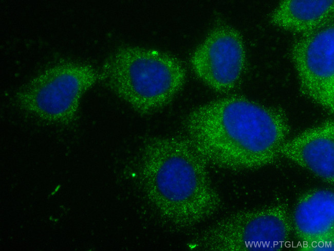 UBE2D1/2/3/4 Antibody in Immunocytochemistry (ICC/IF)