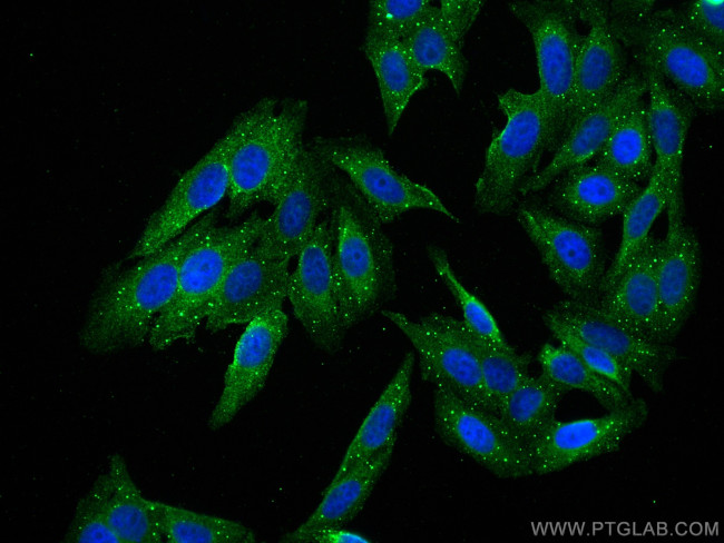 ECH1 Antibody in Immunocytochemistry (ICC/IF)