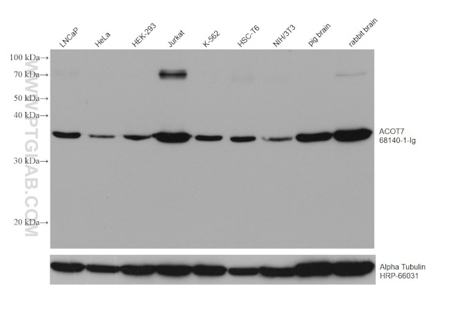 ACOT7 Antibody in Western Blot (WB)