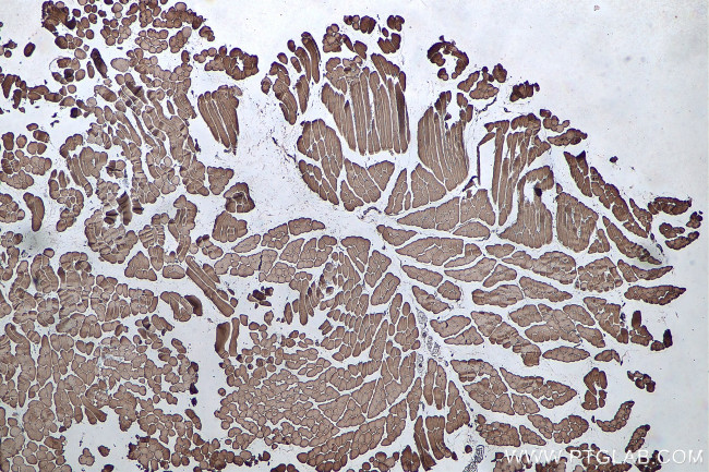 MYL6 Antibody in Immunohistochemistry (Paraffin) (IHC (P))