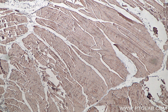 MYL6 Antibody in Immunohistochemistry (Paraffin) (IHC (P))