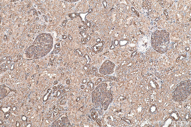 MYL6 Antibody in Immunohistochemistry (Paraffin) (IHC (P))