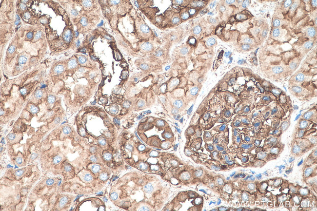 MYL6 Antibody in Immunohistochemistry (Paraffin) (IHC (P))