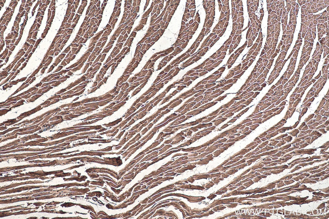 MYL6 Antibody in Immunohistochemistry (Paraffin) (IHC (P))