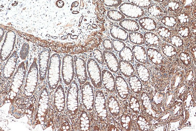 MYL6 Antibody in Immunohistochemistry (Paraffin) (IHC (P))