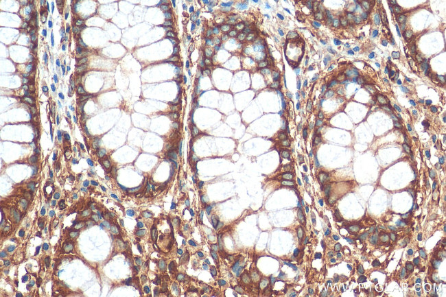 MYL6 Antibody in Immunohistochemistry (Paraffin) (IHC (P))