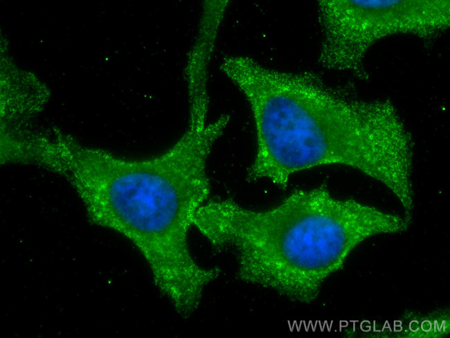 ARPC2 Antibody in Immunocytochemistry (ICC/IF)