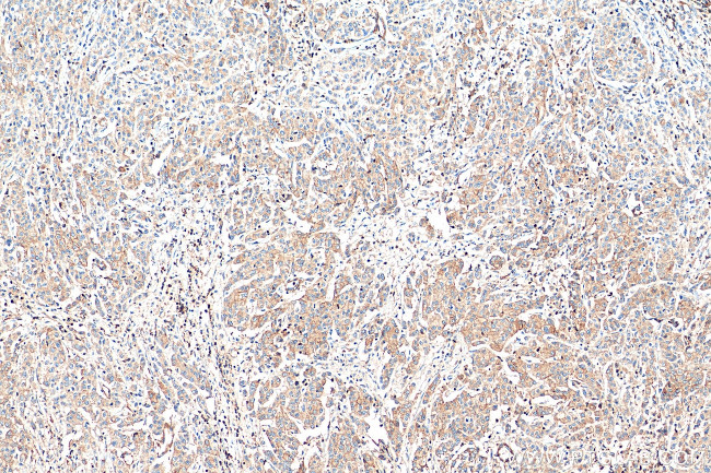 ARPC2 Antibody in Immunohistochemistry (Paraffin) (IHC (P))