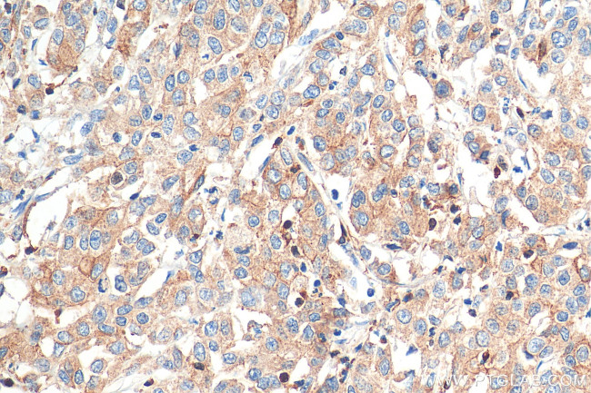 ARPC2 Antibody in Immunohistochemistry (Paraffin) (IHC (P))