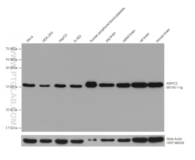 ARPC2 Antibody in Western Blot (WB)