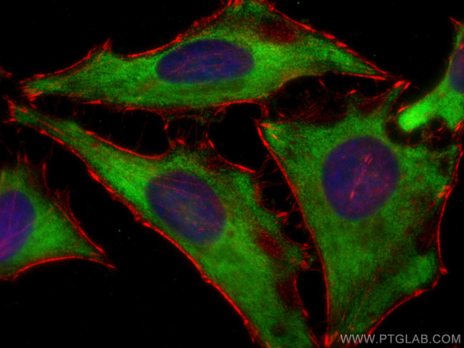 EEF1G Antibody in Immunocytochemistry (ICC/IF)