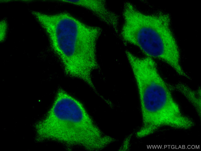 EEF1G Antibody in Immunocytochemistry (ICC/IF)