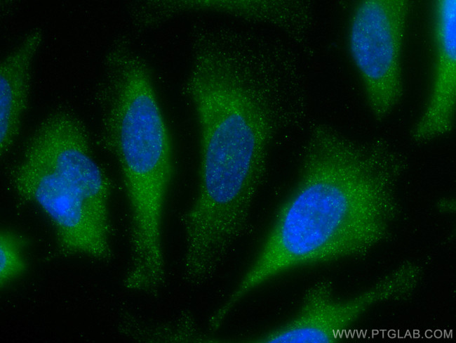 STIP1 Antibody in Immunocytochemistry (ICC/IF)