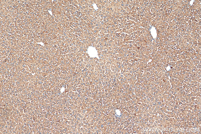 STIP1 Antibody in Immunohistochemistry (Paraffin) (IHC (P))