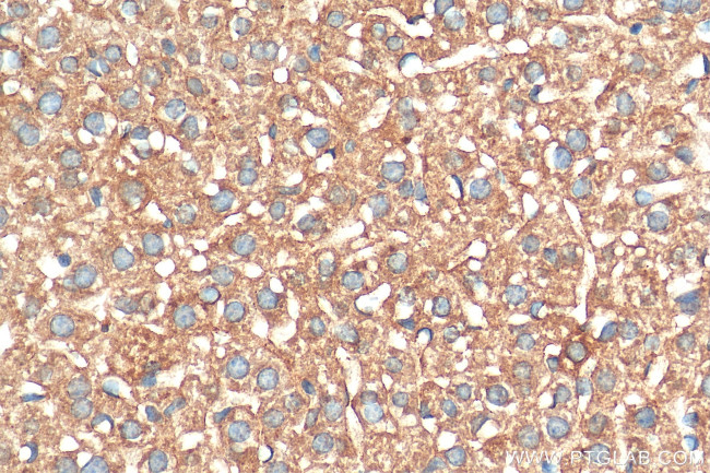 STIP1 Antibody in Immunohistochemistry (Paraffin) (IHC (P))