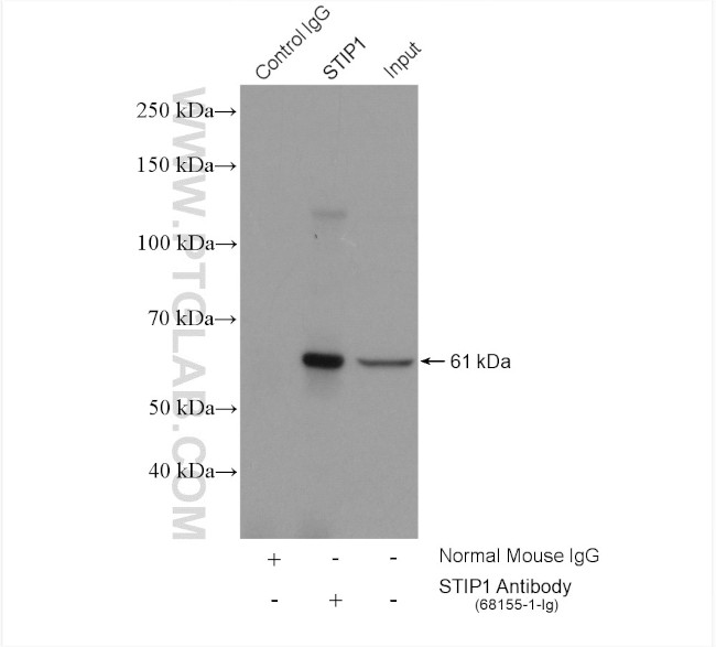 STIP1 Antibody in Immunoprecipitation (IP)