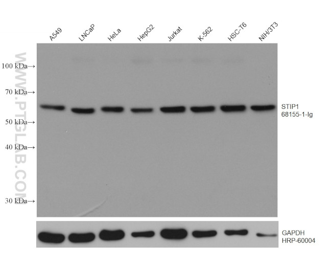 STIP1 Antibody in Western Blot (WB)