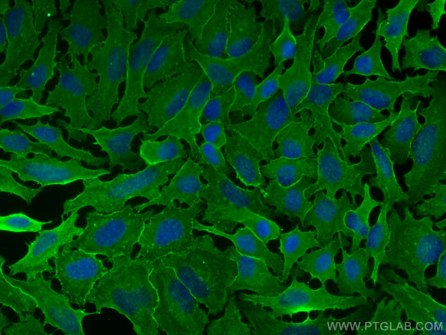 GNAI3 Antibody in Immunocytochemistry (ICC/IF)