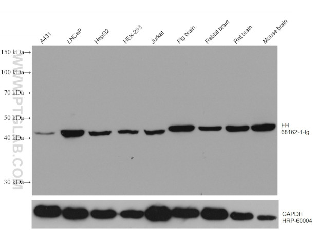 FH Antibody in Western Blot (WB)