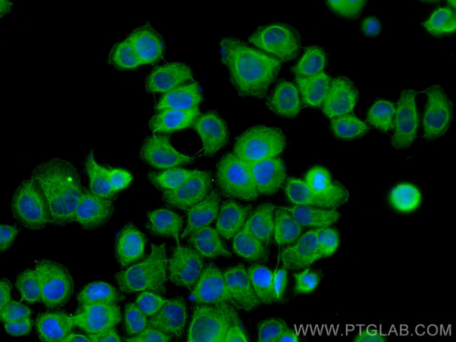 TCEB1 Antibody in Immunocytochemistry (ICC/IF)