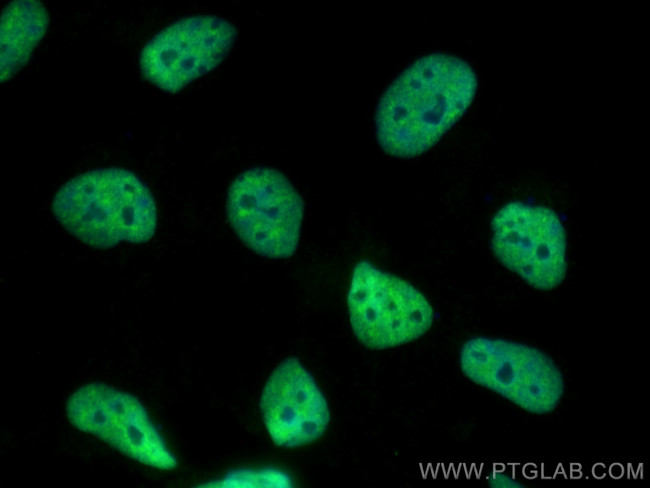 U2AF2 Antibody in Immunocytochemistry (ICC/IF)