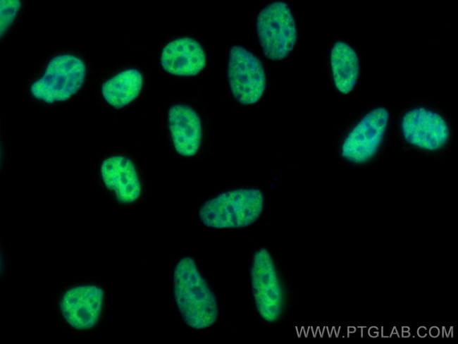 U2AF2 Antibody in Immunocytochemistry (ICC/IF)