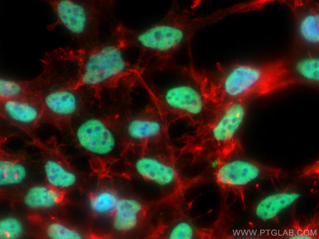 U2AF2 Antibody in Immunocytochemistry (ICC/IF)