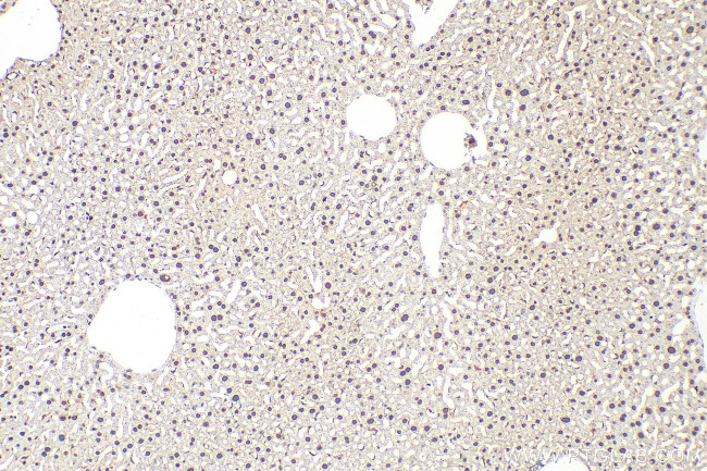 U2AF2 Antibody in Immunohistochemistry (Paraffin) (IHC (P))