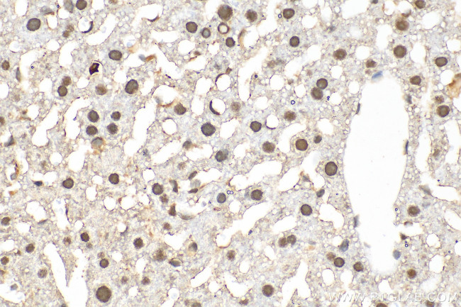 U2AF2 Antibody in Immunohistochemistry (Paraffin) (IHC (P))