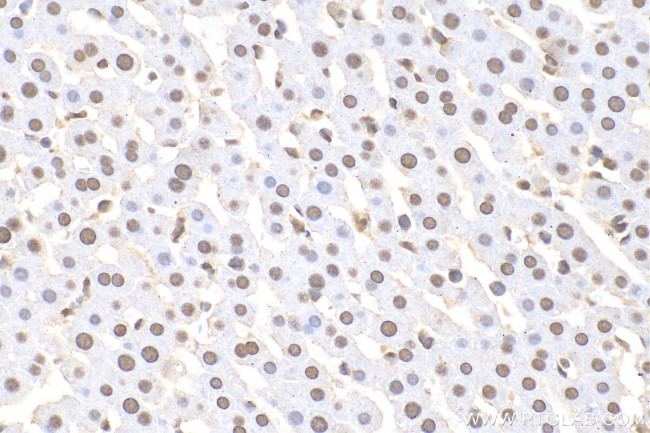 U2AF2 Antibody in Immunohistochemistry (Paraffin) (IHC (P))