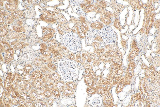 NIT2 Antibody in Immunohistochemistry (Paraffin) (IHC (P))