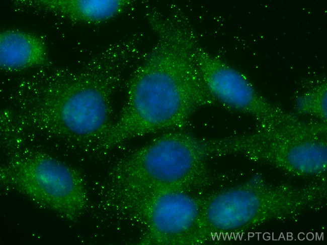 TOLLIP Antibody in Immunocytochemistry (ICC/IF)