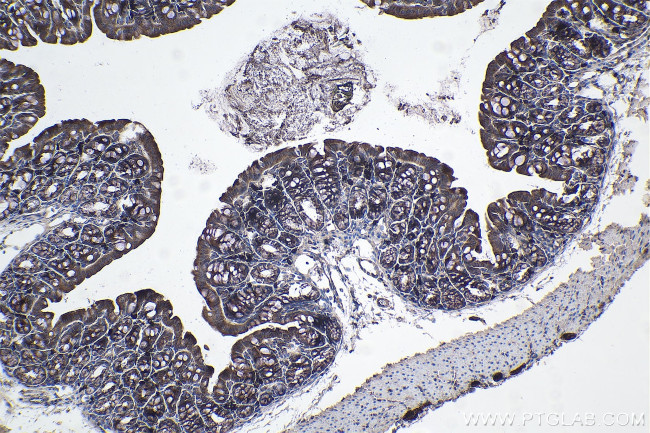 TOLLIP Antibody in Immunohistochemistry (Paraffin) (IHC (P))