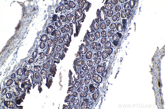 TOLLIP Antibody in Immunohistochemistry (Paraffin) (IHC (P))