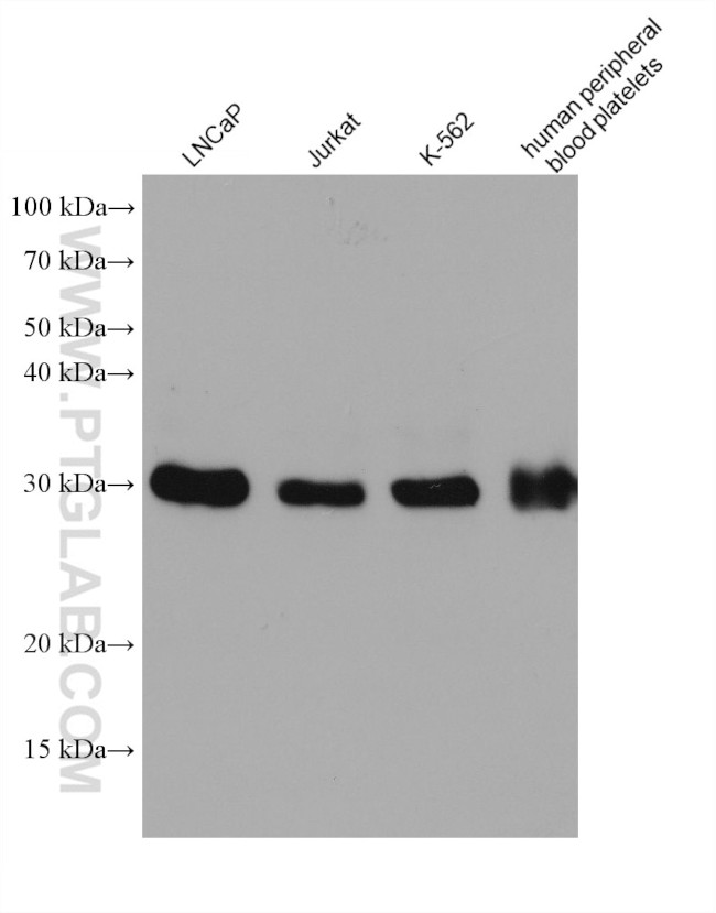 TOLLIP Antibody in Western Blot (WB)