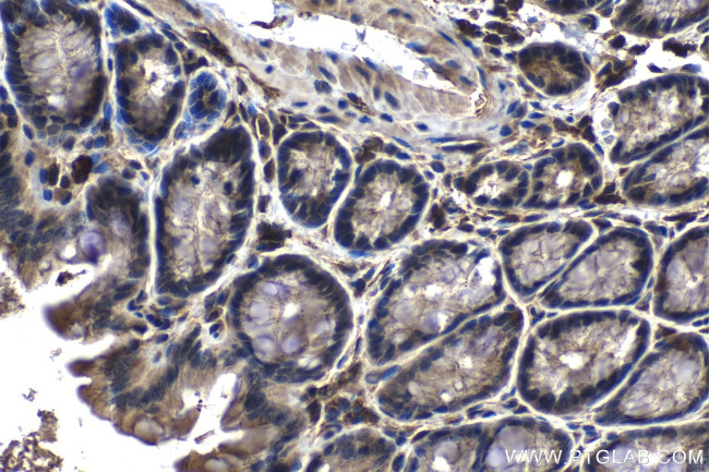 EIF4E3 Antibody in Immunohistochemistry (Paraffin) (IHC (P))