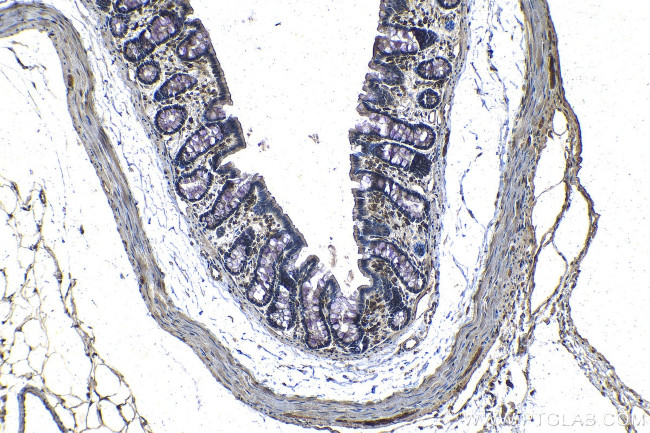 EIF4E3 Antibody in Immunohistochemistry (Paraffin) (IHC (P))