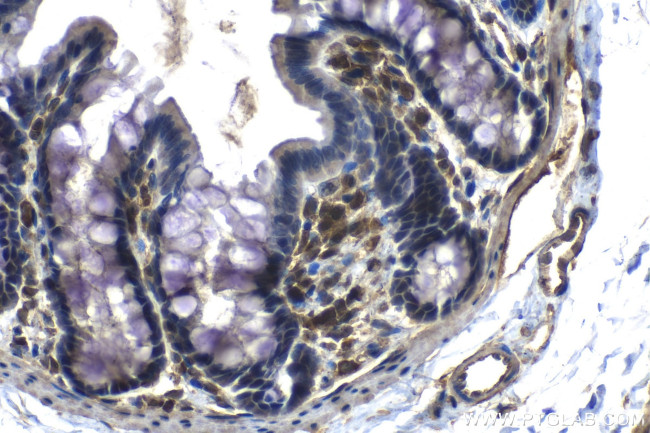 EIF4E3 Antibody in Immunohistochemistry (Paraffin) (IHC (P))