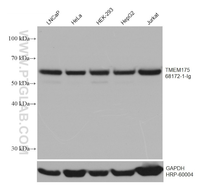 TMEM175 Antibody in Western Blot (WB)