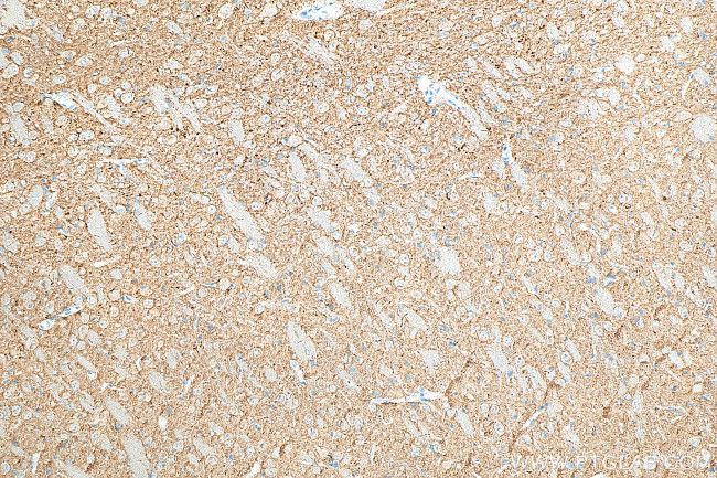 SYNGR1 Antibody in Immunohistochemistry (Paraffin) (IHC (P))