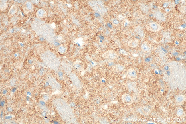 SYNGR1 Antibody in Immunohistochemistry (Paraffin) (IHC (P))