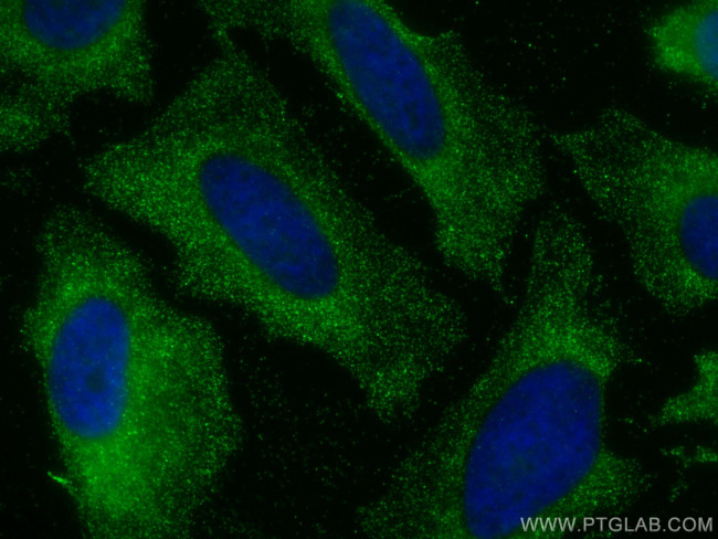 PPA1 Antibody in Immunocytochemistry (ICC/IF)