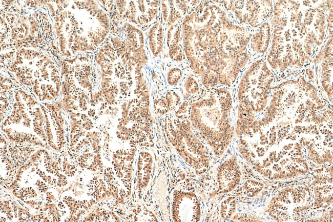 NSFL1C Antibody in Immunohistochemistry (Paraffin) (IHC (P))