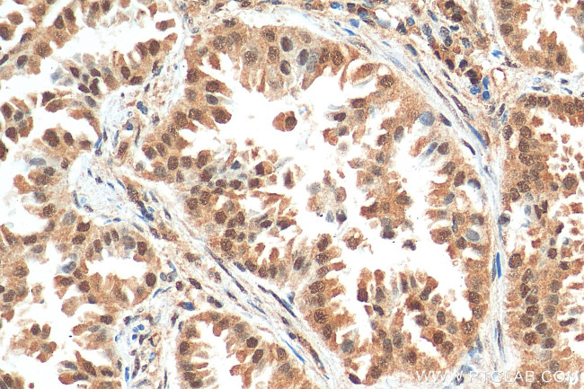 NSFL1C Antibody in Immunohistochemistry (Paraffin) (IHC (P))