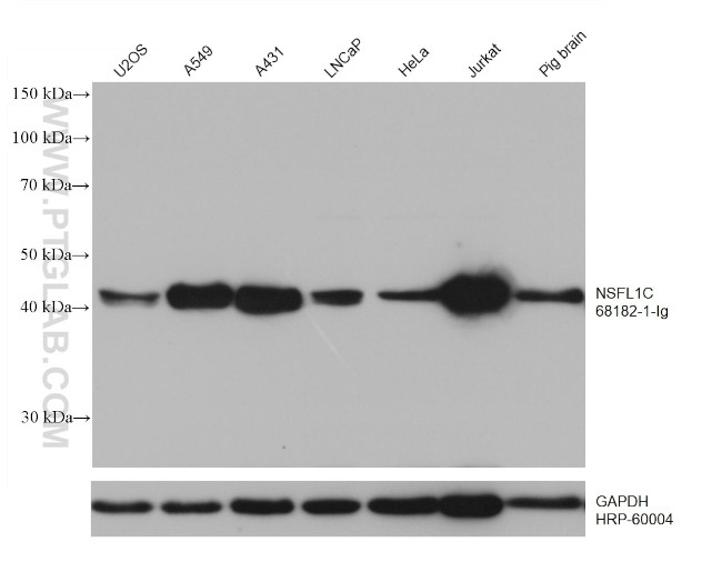 NSFL1C Antibody in Western Blot (WB)