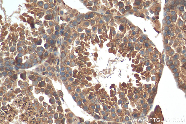 CAPZB Antibody in Immunohistochemistry (Paraffin) (IHC (P))