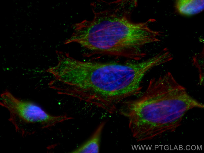 NNT Antibody in Immunocytochemistry (ICC/IF)