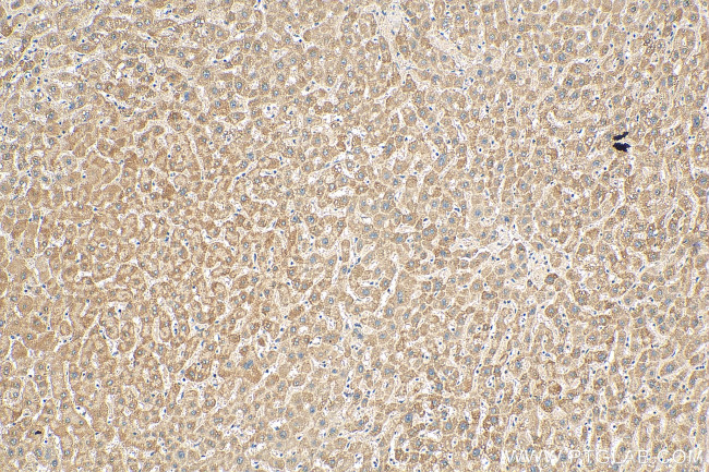 NNT Antibody in Immunohistochemistry (Paraffin) (IHC (P))